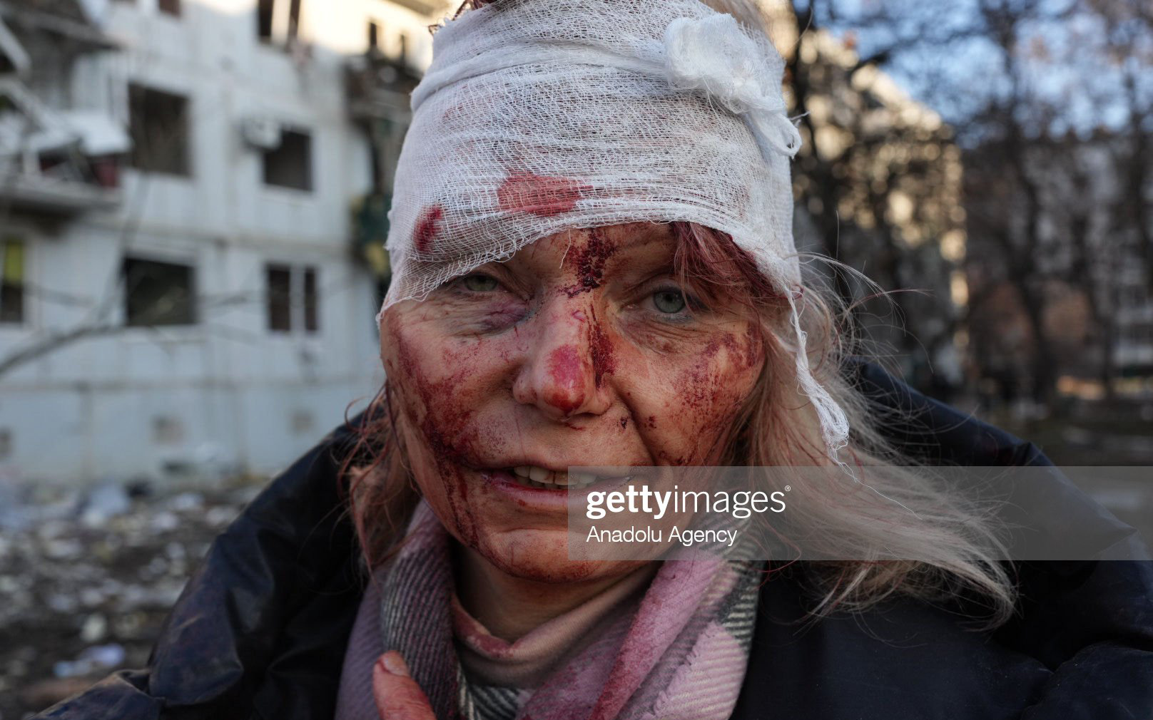 Những hình ảnh tang thương và loạn lạc tại Ukraine sau cuộc không kích