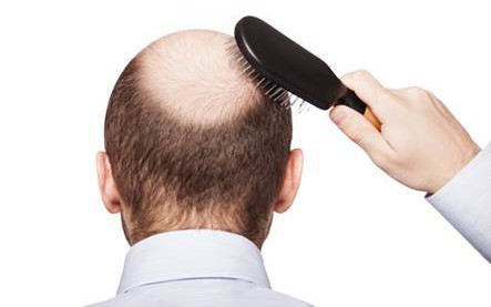 Cẩn thận sập bẫy phòng khám “tự phong" chữa rụng tóc, hói đầu bằng công nghệ nước ngoài 